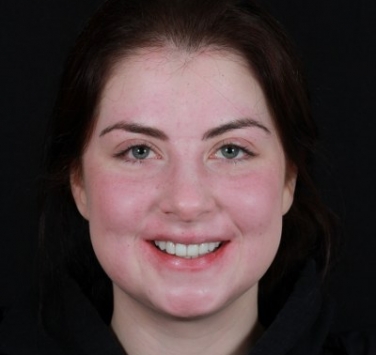 Smile Gallery - Church Road Dental and Cosmetic