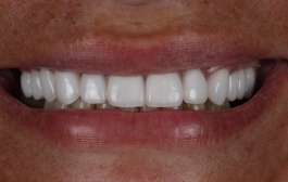 Smile Gallery - Church Road Dental and Cosmetic
