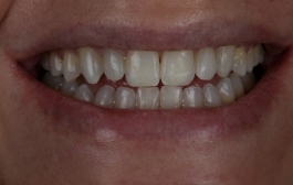 Smile Gallery - Church Road Dental and Cosmetic
