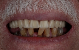 Smile Gallery - Church Road Dental and Cosmetic