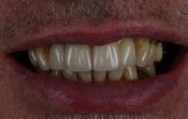 Smile Gallery - Church Road Dental and Cosmetic