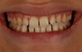 Smile Gallery - Church Road Dental and Cosmetic