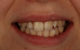 Smile Gallery - Church Road Dental and Cosmetic