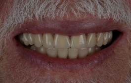 Smile Gallery - Church Road Dental and Cosmetic