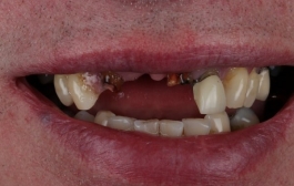Smile Gallery - Church Road Dental and Cosmetic