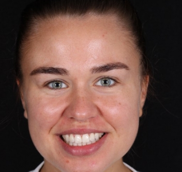 Smile Gallery - Church Road Dental and Cosmetic