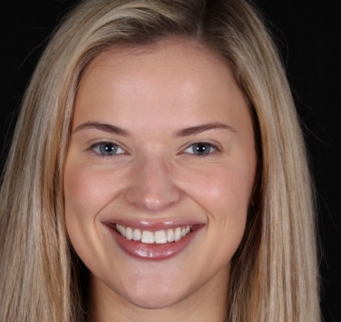 Smile Gallery - Church Road Dental and Cosmetic