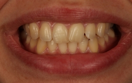 Smile Gallery - Church Road Dental and Cosmetic