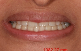 Smile Gallery - Church Road Dental and Cosmetic