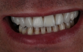 Smile Gallery - Church Road Dental and Cosmetic