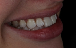 Smile Gallery - Church Road Dental and Cosmetic