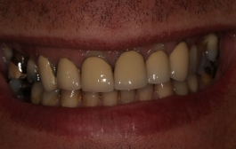 Smile Gallery - Church Road Dental and Cosmetic