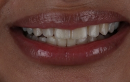 Smile Gallery - Church Road Dental and Cosmetic