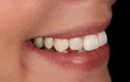 Smile Gallery - Church Road Dental and Cosmetic