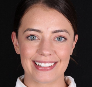 Smile Gallery - Church Road Dental and Cosmetic