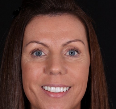 Smile Gallery - Church Road Dental and Cosmetic