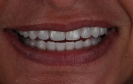 Smile Gallery - Church Road Dental and Cosmetic