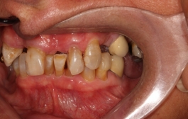 Smile Gallery - Church Road Dental and Cosmetic