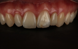 Smile Gallery - Church Road Dental and Cosmetic
