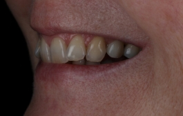 Smile Gallery - Church Road Dental and Cosmetic
