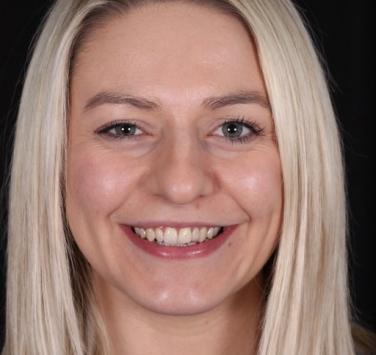 Smile Gallery - Church Road Dental and Cosmetic