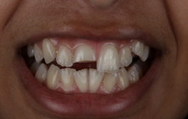 Smile Gallery - Church Road Dental and Cosmetic