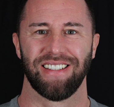 Smile Gallery - Church Road Dental and Cosmetic