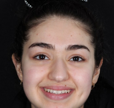 Smile Gallery - Church Road Dental and Cosmetic