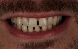 Smile Gallery - Church Road Dental and Cosmetic