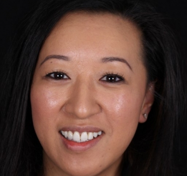 Smile Gallery - Church Road Dental and Cosmetic
