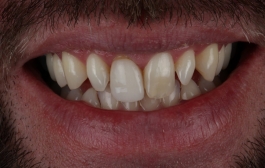 Smile Gallery - Church Road Dental and Cosmetic