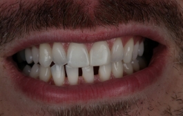 Smile Gallery - Church Road Dental and Cosmetic