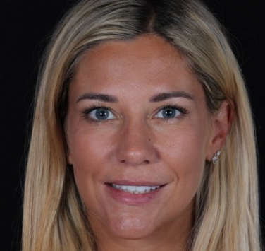 Smile Gallery - Church Road Dental and Cosmetic