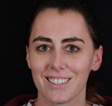 Smile Gallery - Church Road Dental and Cosmetic