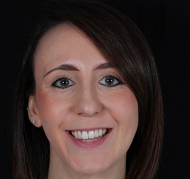 Smile Gallery - Church Road Dental and Cosmetic