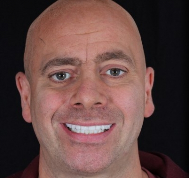 Smile Gallery - Church Road Dental and Cosmetic