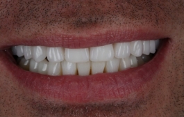 Smile Gallery - Church Road Dental and Cosmetic