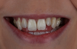 Smile Gallery - Church Road Dental and Cosmetic