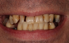 Smile Gallery - Church Road Dental and Cosmetic