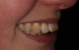 Smile Gallery - Church Road Dental and Cosmetic