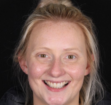 Smile Gallery - Church Road Dental and Cosmetic