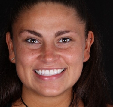 Smile Gallery - Church Road Dental and Cosmetic