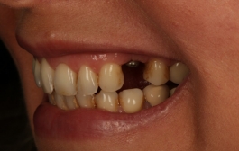 Smile Gallery - Church Road Dental and Cosmetic