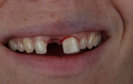 Smile Gallery - Church Road Dental and Cosmetic