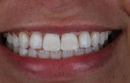 Smile Gallery - Church Road Dental and Cosmetic