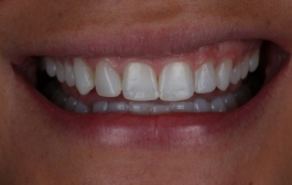 Smile Gallery - Church Road Dental and Cosmetic