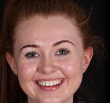 Smile Gallery - Church Road Dental and Cosmetic