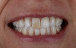 Smile Gallery - Church Road Dental and Cosmetic