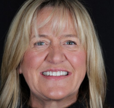 Smile Gallery - Church Road Dental and Cosmetic