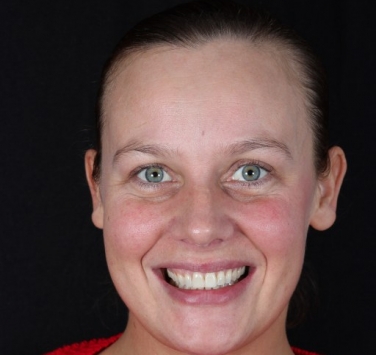 Smile Gallery - Church Road Dental and Cosmetic